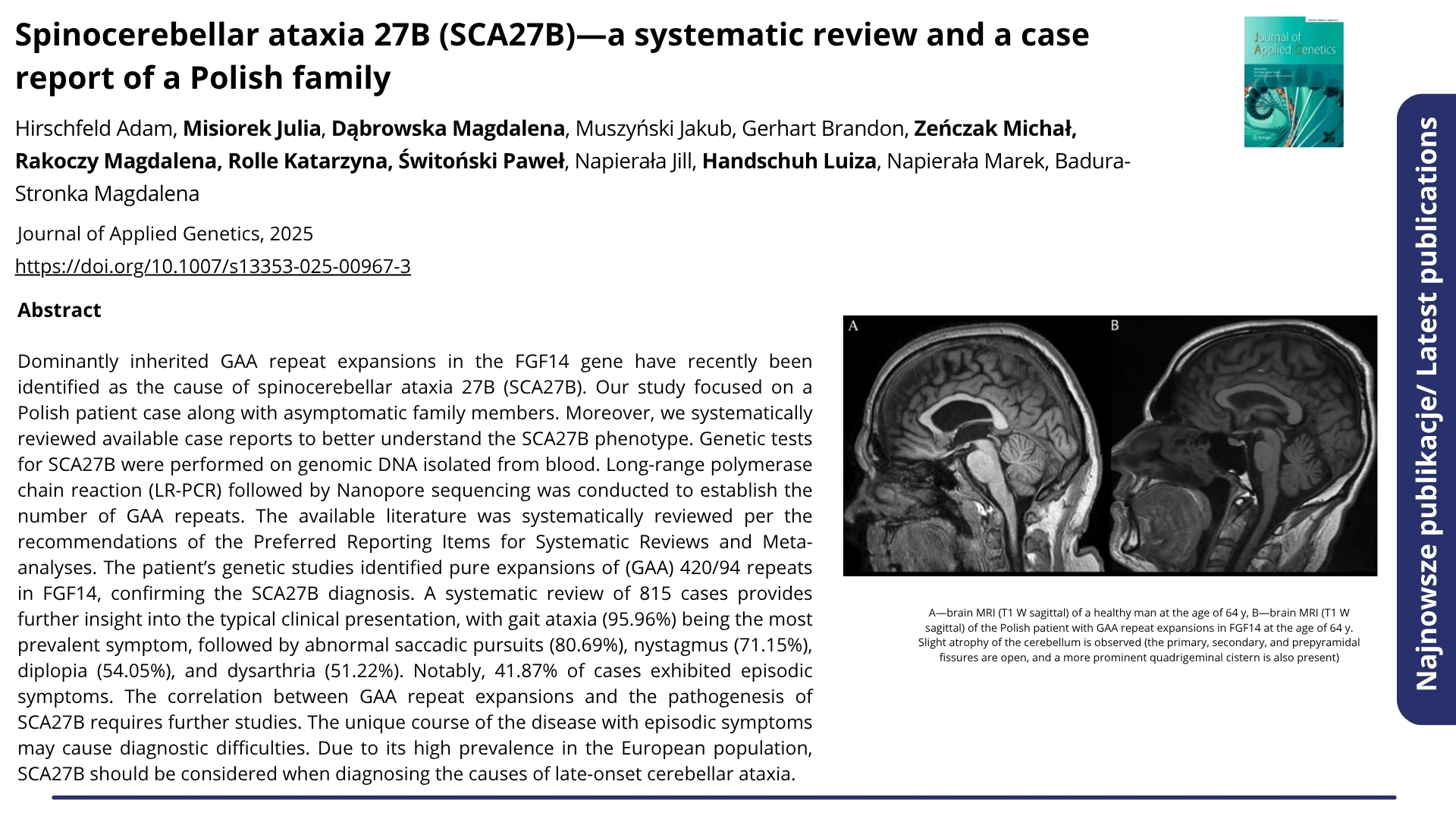 Najnowsze publikacje. Nagłówek: &quot;Spinocerebellar ataxia 27B (SCA27B)—a systematic review and a case report of a Polish family&quot;. Journal of Applied Genetics, 2025. Autorzy: Hirschfeld Adam, Misiorek Julia, Dąbrowska Magdalena, Muszyński Jakub, Gerhart Brandon, Zeńczak Michał, Rakoczy Magdalena, Rolle Katarzyna, Świtoński Paweł, Napierała Jill, Handschuh Luiza, Napierała Marek, Badura-Stronka Magdalena. Poniżej abstrakt.