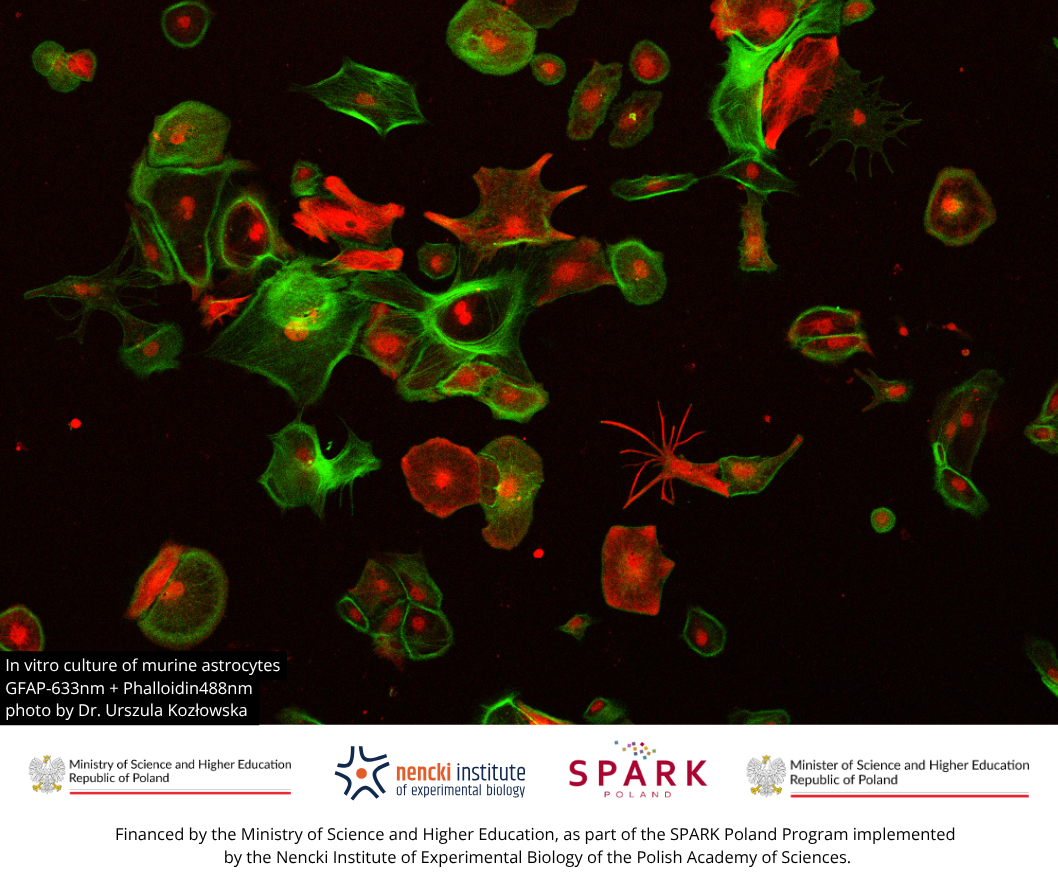 In vitro culture of murine astrocytes GFAP-633nm + Phalloidin488nm photo by Dr. Urszula Kozłowska