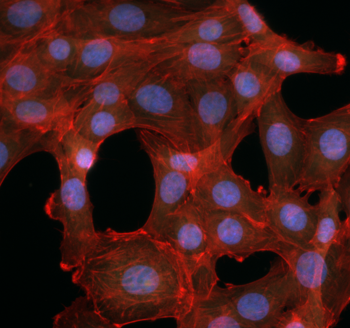 Human cells under a fluorescence microscope, nuclei stained blue, cytoplasm stained red.