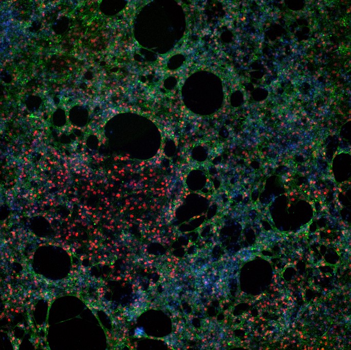  Human cardiomyocytes under a fluorescence microscope, stained with specific cell markers in various colors.